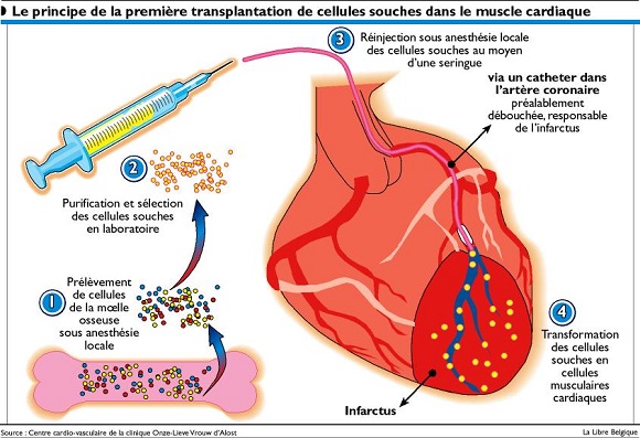 cardiaque-cellules-souches1