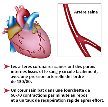 Carroussel FR healthy heart