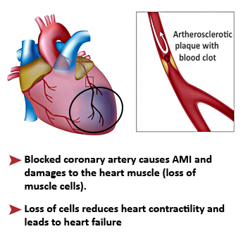 Carroussel EN - AMI heart - EN