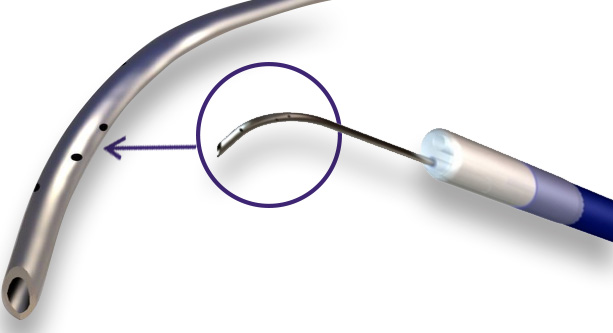 catheter-caroussel-1